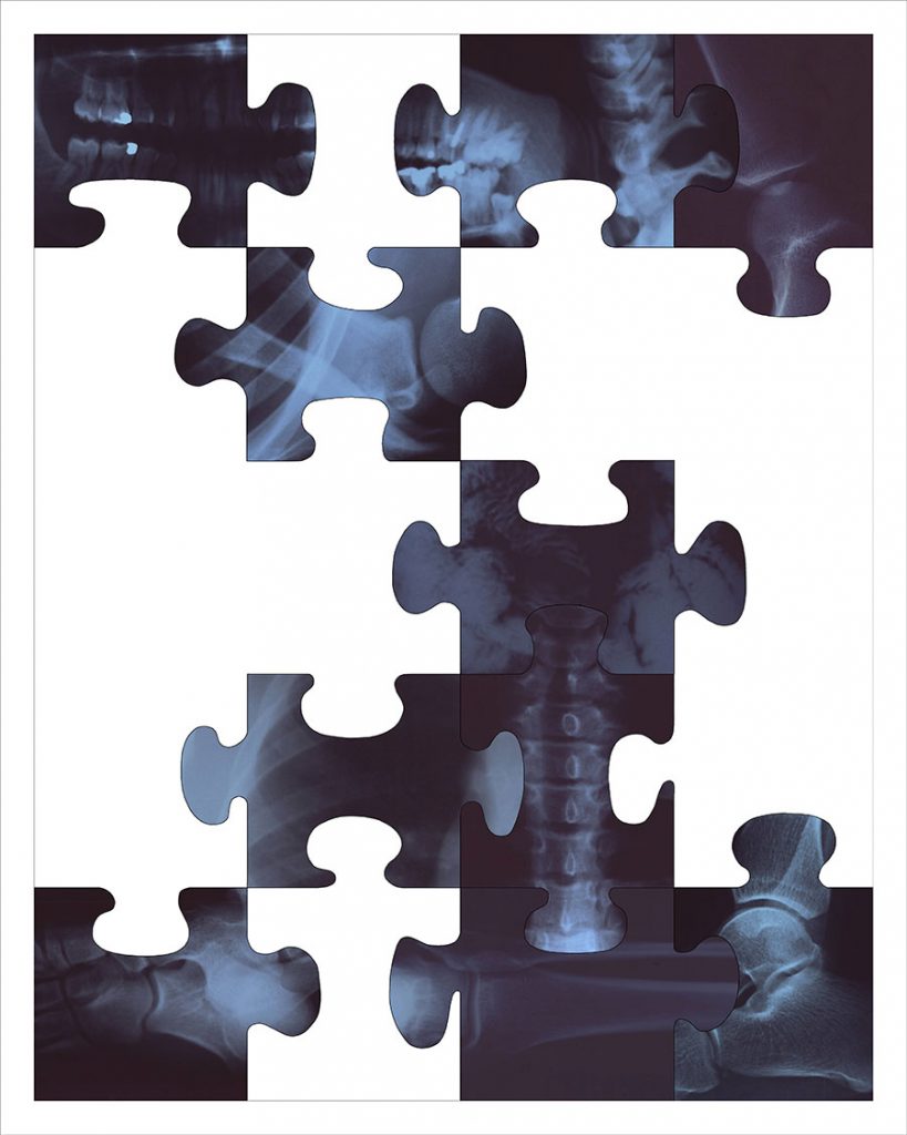 Estampe numérique, organe humain en forme de pièces de puzzle
